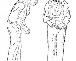 parkinsonská poloha