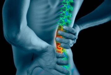 bolesti bedrovej chrbtice