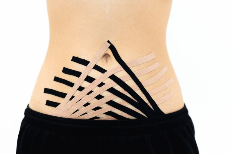 Kinesio Taping  (tejpovanie) pri liečbe bolestí chrbtice